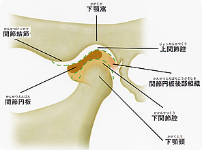 顎関節症